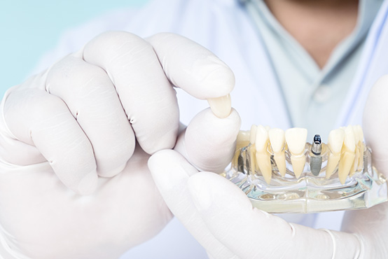 A dental professional wearing gloves and holding a tray with teeth and surgical instruments.