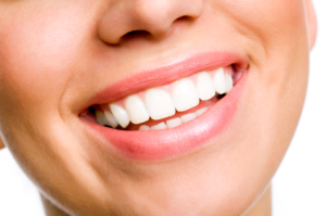 teeth whitening Trinity FL