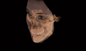 Sample image from a GALILEOS® 3D X-Ray showing a patient's face and jaw.