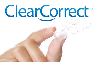 ClearCorrect clear aligners