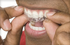 get straight teeth using braces for adults with a Palm Harbor dentist New Port Richey