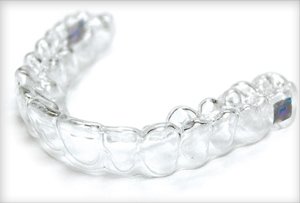 straight teeth for a perfect smile with a dentist in Trinity FL and New Port Richey