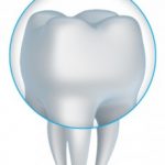 Porcelain crowns in Trinity and Palm Harbor help patients to improve their smiles quickly.