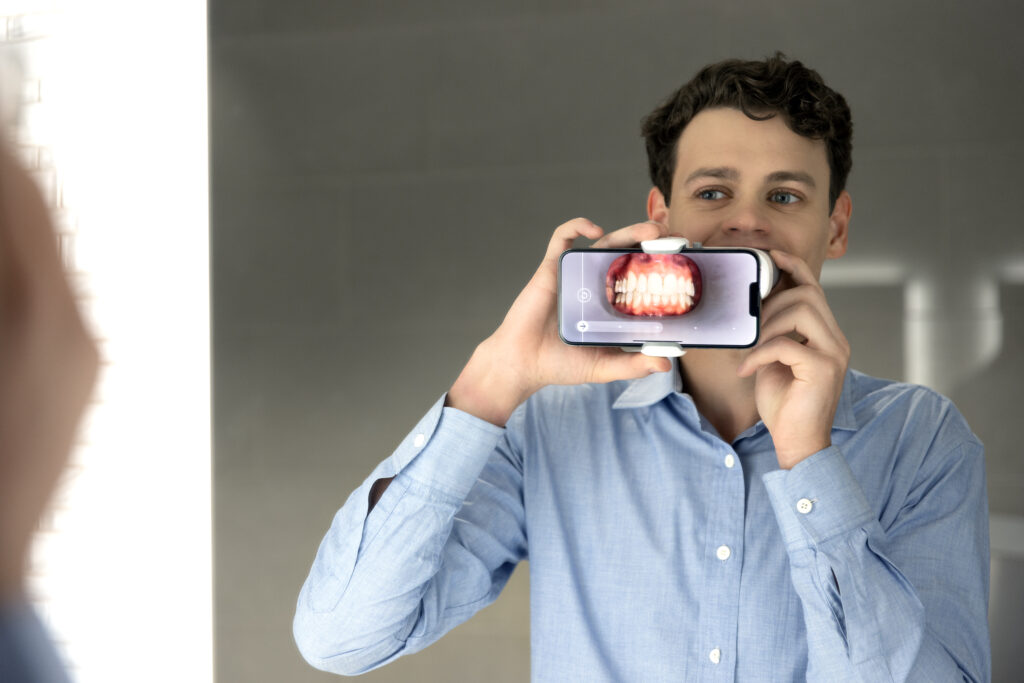 Taking teeth impressions for Candid Clear ALign