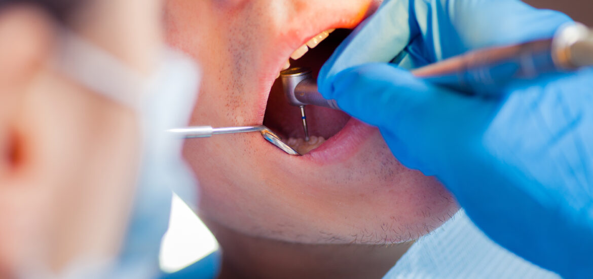 doctor examining a tooth that needs pulling